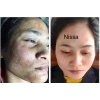 Bộ kem nám ngày đêm Nissa Collagen- Giảm nám, da sáng mịn, giá ưu đãi 790.000₫ 8
