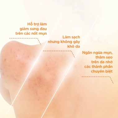 Bộ ngừa mụn toàn thân Decumar STA01 XDA02 - Da sạch, giảm mụn, giá 438.000₫ 4