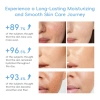 Bộ Quà Tặng LAIKOU Chăm Sóc Da – Dưỡng Ẩm Serum Mắt Kem + Sữa Rửa Mặt – Kẹp Vịt Dễ Thương – Giá 262.900₫ 5