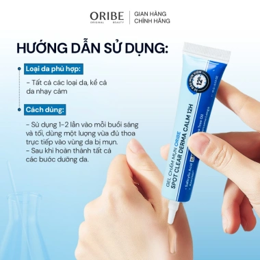 Bộ Sản Phẩm Sạch Da Ngừa Mụn Oribe Soft Touch 100gr + Chấm Mụn - Da sạch, chống mụn hiệu quả, Giảm giá đặc biệt chỉ 265.000đ ngay 5