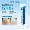 Bộ Sản Phẩm Sạch Da Ngừa Mụn Oribe Soft Touch 100gr + Chấm Mụn - Da sạch, chống mụn hiệu quả, Giảm giá đặc biệt chỉ 265.000đ ngay 6