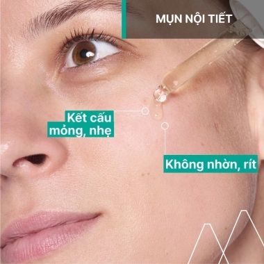 Bộ serum 30ml + gel rửa mặt URIAGE HYSEAC 150ml - Kháng khuẩn, giảm mụn da dầu