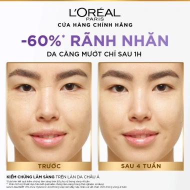 Bộ Serum Cấp Ẩm Sáng Da + Kem Dưỡng Revitalift Hyaluronic Acid - Siêu ẩm giảm nếp nhăn, giá 406.000 VND 7 Bộ Serum Cấp Ẩm Sáng Da + Kem Dưỡng Revitalift Hyaluronic Acid - Siêu ẩm giảm nếp nhăn, giá 406.000 VND 7