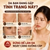 Bộ Skincare 7 Món Mạ Vàng CIYAOO x Cosmax Korea - Dưỡng Ẩm, Săn Chắc, Trẻ Hóa Da, Quà Tặng Sang Trọng 699.000 VND 3