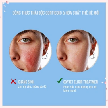 Bộ Thải Độc Oxy Tươi Désembre Oxyjet Elixir Treatment Giảm Độc Tố, Da Sáng Mịn, Giá Ưu Đãi 2.15 Triệu 3