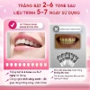 Bộ trắng răng Smilee Extra 2-6 tone tại nhà, kèm 3 bút gel LIS - Giá chỉ 950.000đ 4