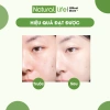 Bột Cà Phê Tẩy Da Chết - Mặt Nạ Dưỡng Da Chống Lão Hóa - Natural Life 38.000đ 4