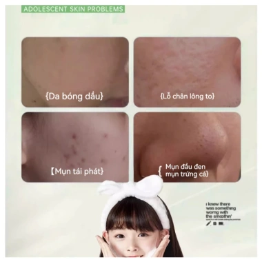 Bọt rửa mặt cho bé 170ml - Axit amin, làm sạch da, loại bỏ bụi bẩn, 150.000 VND 2