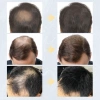 Bột Sợi Đen Toppik 27,5g - Giao Hàng Nhanh, Dày Tóc Mỏng, Tóc Hói, Cloud2 (Thủy Tinh) Giá Ưu Đãi 80.905₫ 5