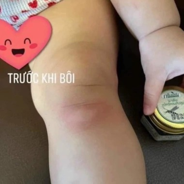 Cao bôi muỗi côn trùng Herbal Balm Green Herb Citronella Thái Lan 20gr - Giá 40.000