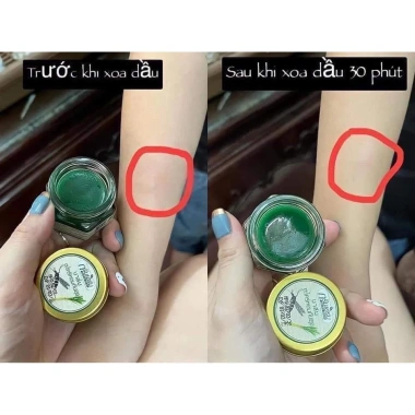 Cao Bôi Muỗi Đốt Dầu Cù Là Sả Green Herb Balm Thái Lan Chiết Xuất Thảo Dược An Toàn Cho Bé 20g Giá Ưu Đãi 49k