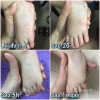 Cao bôi muỗi đốt Thái Lan - Hiệu quả xua đuổi muỗi, không mùi, giảm giá 45.000đ 3