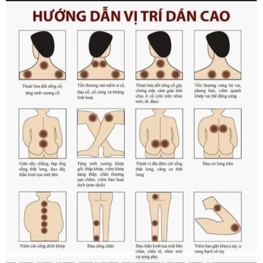 Cao dán xương khớp 6 gói 10 miếng - Giảm đau lưng, thoát vị đĩa đệm, siêu hiệu quả, giá 130k 2