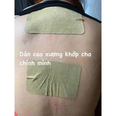 Cao dán xương khớp hộp 50 miếng - Giá chỉ 85.000 VNĐ, giảm tới 20% - Hỗ trợ giảm đau, tăng sức khỏe xương khớp 6