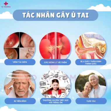 Cao Giảm Ù Tai Erminggao Nhật Bản 30g - Giảm Áp Lực, Đau Tai, Nghe Kém, Ngủ Ngon