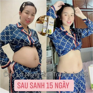 Cao lá nóng gia truyền tan mỡ, dùng chung đai nịt bụng - Tặng thước dây, giảm giá 25.000₫ 3