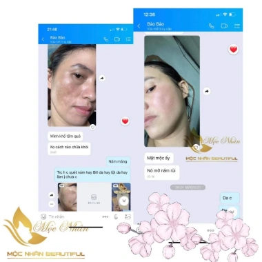 Cao Sâm Tái Tạo Da Mộc Nhân Dưỡng Trắng Da Thiên Nhiên Giá Ưu Đãi 390.000₫