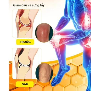 Cao Xoa Bóp Xương Khớp Cổ MIAOJIANG – Giảm Đau Thảo Dược Gối, Thắt Lưng, Cổ Vai Gáy – 145.000đ
