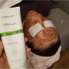 Christina Herbal Peel 4A Biophyto - Tẩy Da Chết Sâu, Loại Bỏ Mụn Cám Đầu Đen