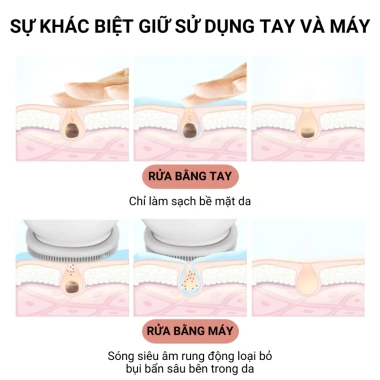 Chuột Rửa Mặt KKS-155 4 trong 1: Sạch sâu, tẩy trang, massage nâng cơ - Giá ưu đãi 659.000₫
