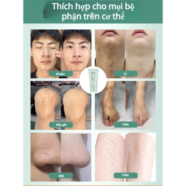 COD Tẩy tế bào chết da trắng mịn – Gel làm sạch sâu lô hội, thu nhỏ lỗ chân lông thảo dược, giảm 23% 7