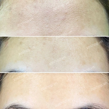 Collagen Beauty 7.000 Plus DHC nhập khẩu – da mịn, giảm nếp nhăn, chỉ 990.000 VND 3 Collagen Beauty 7.000 Plus DHC nhập khẩu – da mịn, giảm nếp nhăn, chỉ 990.000 VND 3