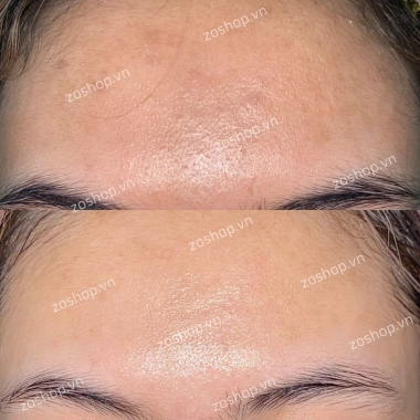 Collagen Beauty 7.000 Plus DHC nhập khẩu – da mịn, giảm nếp nhăn, chỉ 990.000 VND 4 Collagen Beauty 7.000 Plus DHC nhập khẩu – da mịn, giảm nếp nhăn, chỉ 990.000 VND 4