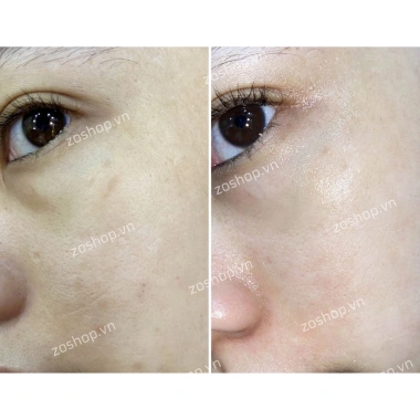 Collagen Beauty 7.000 Plus DHC nhập khẩu – da mịn, giảm nếp nhăn, chỉ 990.000 VND 5 Collagen Beauty 7.000 Plus DHC nhập khẩu – da mịn, giảm nếp nhăn, chỉ 990.000 VND 5