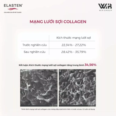 Collagen Elasten 3 Hộp - Da Căng Mịn, Chống Lão Hóa, Tóc Khỏe | 8,664,000₫
