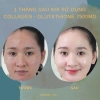 Collagen Glutathione 7.500mg Viên Uống Trắng Da Nâng Tone Cấp Tốc Giảm Nám Mờ Thâm 5