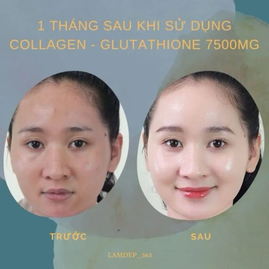 Collagen Glutathione 7.500mg Viên Uống Trắng Da Nâng Tone Cấp Tốc Giảm Nám Mờ Thâm 5