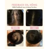 Combo 2 Dầu Hồng và Xanh ủ kích mọc tóc - Giảm gãy rụng, tóc bóng khỏe, suông mềm - Giá chỉ 149.000đ 5