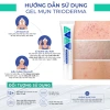 Combo 2 Gel chấm mụn Trioderma Anti Acne Gel 15g - Mờ thâm, giảm mụn, giá 345.000 5