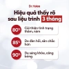 Combo 3 set Collagen Lựu đỏ Curcumin Dr Halee 9 hộp 10 gói Giá chỉ 2.295.000 VNĐ 4
