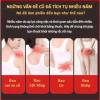 Combo 3 Túi 150 Miếng Cao Dán Gừng Giảm Đau Mỏi Xương Khớp, Tê Bì Tay Chân 19.000 VNĐ 3