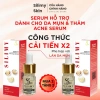 Combo 4 Lọ Serum SILIMY SKIN 5ml Mua 2 Tặng 2 - Giảm mụn, kiềm dầu, sáng da, dưỡng ẩm - Giá chỉ 392.000₫