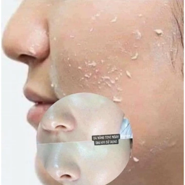 Combo 50 gói Tẩy Tế Bào Chết Ohui Clear Science Soft Peeling 1ml - Da Sáng Mềm, Giá 39.000 5 Combo 50 gói Tẩy Tế Bào Chết Ohui Clear Science Soft Peeling 1ml - Da Sáng Mềm, Giá 39.000 5