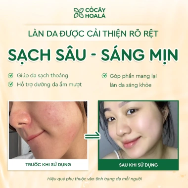 Combo chăm sóc da đậu đỏ cỏ cây 150g: làm sạch sâu, dưỡng ẩm, dưỡng sáng, tặng mini size