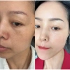 Combo Chăm Sóc Da MIESHO HA 4 món - Dưỡng ẩm, cải thiện da tối màu, nâng tông nhẹ nhàng, giá chỉ 750.000 VND 3