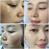 Combo Chăm Sóc Da MIESHO HA 4 món - Dưỡng ẩm, cải thiện da tối màu, nâng tông nhẹ nhàng, giá chỉ 750.000 VND 4