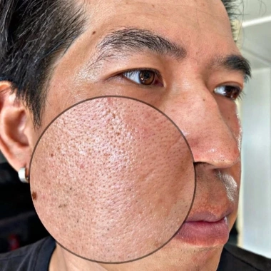 Combo Chăm Sóc Da MIESHO HA 4 món - Dưỡng ẩm, cải thiện da tối màu, nâng tông nhẹ nhàng, giá chỉ 750.000 VND