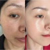 Combo Chăm Sóc Da MIESHO HA 4 món - Dưỡng ẩm, cải thiện da tối màu, nâng tông nhẹ nhàng, giá chỉ 750.000 VND 6