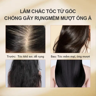 Combo Dầu Gội & Dầu Xả Khổ Sâm Ngăn Rụng Tóc 400ml - Mọc Tóc, Giá Ưu Đãi 400.000VND