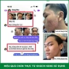 Combo Dr Mai Nguyên Chất và Mix Saffron Đánh Bay Mụn, Sạch Thâm, Tự Nhiên Giá 289k 7