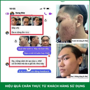 Combo Dr Mai Nguyên Chất và Mix Saffron Đánh Bay Mụn, Sạch Thâm, Tự Nhiên Giá 289k 7 Combo Dr Mai Nguyên Chất và Mix Saffron Đánh Bay Mụn, Sạch Thâm, Tự Nhiên Giá 289k 7
