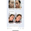 Combo Dưỡng Da Barbie Skin Gói 3 Sản Phẩm Xịt Dưỡng, Mặt Nạ, Sữa Rửa Mặt Giá 790.000 5