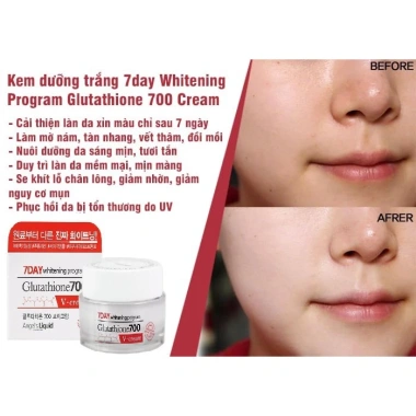 Combo Dưỡng Trắng 7DAY Angel's Liquid - Gutathione 700V Serum + Cream 918.000