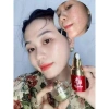 Combo Mụn Huỳnh Đỗ 3 trong 1: Sữa rửa mặt, Kem mụn, Serum giảm mụn, mờ thâm, dưỡng trắng da – 135.000₫ 2