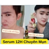 Combo Mụn Huỳnh Đỗ 3 trong 1: Sữa rửa mặt, Kem mụn, Serum giảm mụn, mờ thâm, dưỡng trắng da – 135.000₫ 3