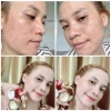 Combo Mụn Huỳnh Đỗ 3 trong 1: Sữa rửa mặt, Kem mụn, Serum giảm mụn, mờ thâm, dưỡng trắng da – 135.000₫ 7